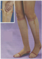 Zipper Copper Compression Open Toe Sock